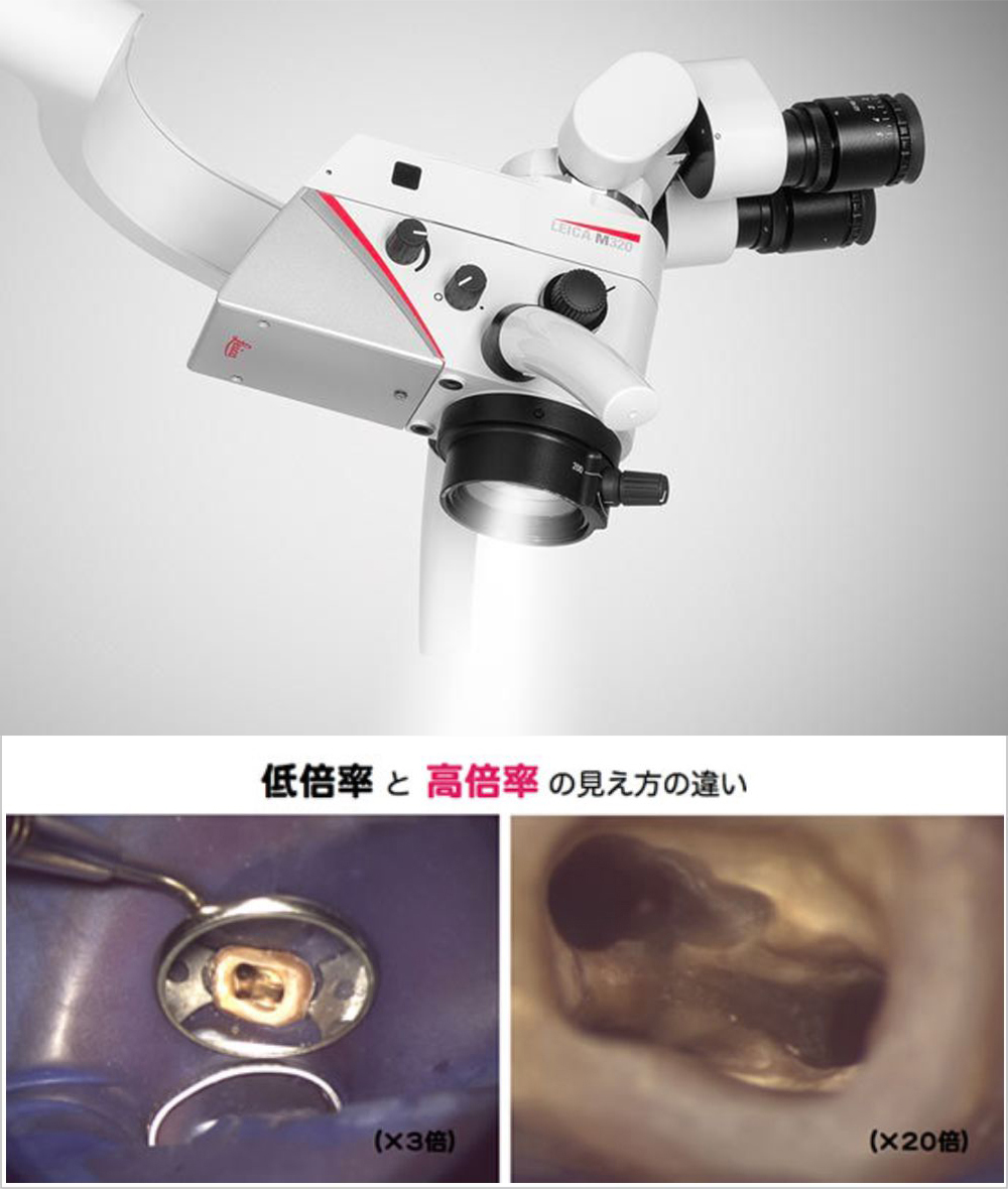 ②歯科用実体顕微鏡(マイクロスコープ LeicaM320-D)